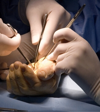 AVN Hip Treatment
in Nashik